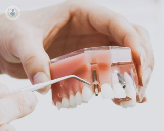 Cirugía guiada en implantología dental