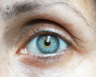 El ojo seco causa picor y molestias en la superficie ocular.