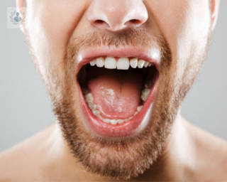 hombre boca abierta implantes topdoctors