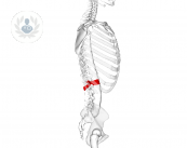 La estenosis de canal es la disminución de los diámetros del canal llumbar donde se encuentran la parte fina de la médula espinal y lar raíces de los nervios de cola de caballo.