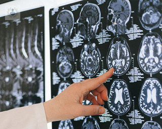 neurólogo con radiografía cerebro