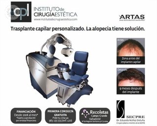 Descubre la última tecnología en el tratamiento de la alopecia en este artículo.