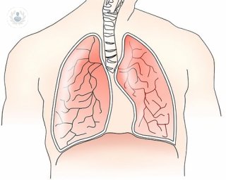 cirugía cáncer pulmón