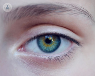 La lente intraocular se implanta en el ojo durante una cirugía con el fin de corregir diferentes defectos refractivos como la miopía, hipermetropía e incluso la presbicia
