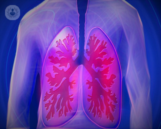 El Dr. Molins nos explica de qué maneras se puede abordar la cirugía del cáncer de pulmón en función del nivel de extirpación.