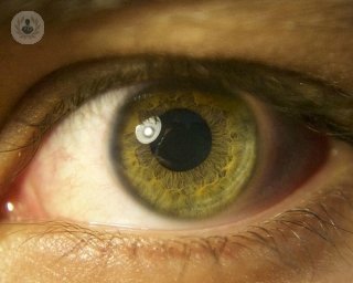 El desprendimiento de retina tiene un síntoma bien claro que es la pérdida de visión del área de esa retina desprendida. Pueden aparecer moscas volantes y destellos.