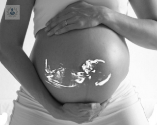 La amniocentesis consiste en la extracción de parte del líquido amniótico durante el embarazo para analizarlo y determinar si existen anomalías antes del nacimiento. 