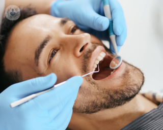 implantes dentales tipos beneficios