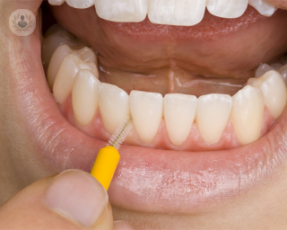 Cepillo de dientes interdental para prevenir periodontitis | Top Doctors