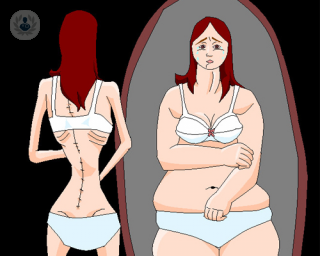 anorexia tca