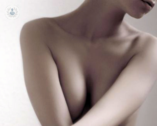 El tratamiento del cáncer de mama a veces supone extirpar parcialmente o de manera total la mama