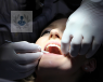 Según la proximidad de la muela del juicio con el nervio dentario inferior puede ser necesaria una coronectomía