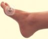 La torcedura del tobillo es una lesión muy frecuente. Sin embargo, un 40% de lesiones de ligamentos de tobillo no se cura correctamente mediante tratamiento conservador.