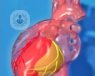 La cardiología intervencionista es una técnica para tratar problemas de la arterias coronarias mediante el uso de catéteres para evitar operar a corazón abierto.