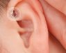 Los problemas de oído se pueden solucionar con cirugía, o sin ella