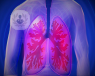 El Dr. Molins nos explica de qué maneras se puede abordar la cirugía del cáncer de pulmón en función del nivel de extirpación.