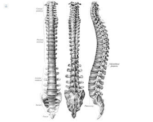 La cifosis es una curvatura de la columna vertebral 