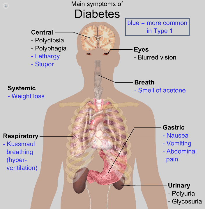 diabetes: síntomas