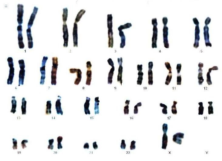 генетическая карта предимплантационной генетической диагностики хромосом