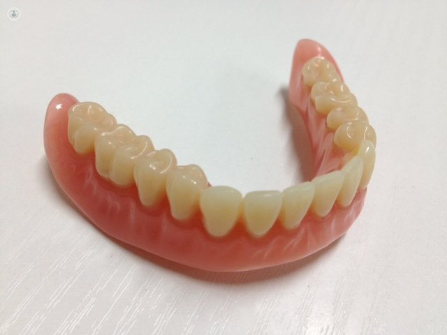 La prótesis mucosoportada se utiliza cuando faltan todos los dientes