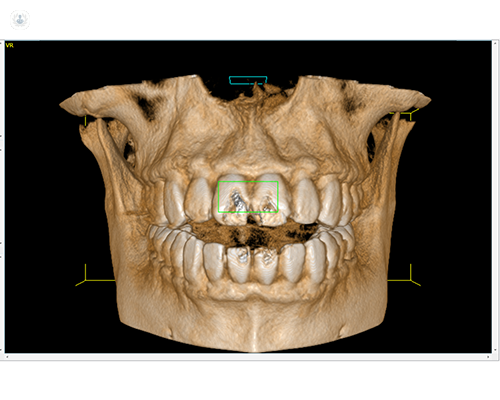 Descubre los beneficios de la tecnología 3D en Odontología.