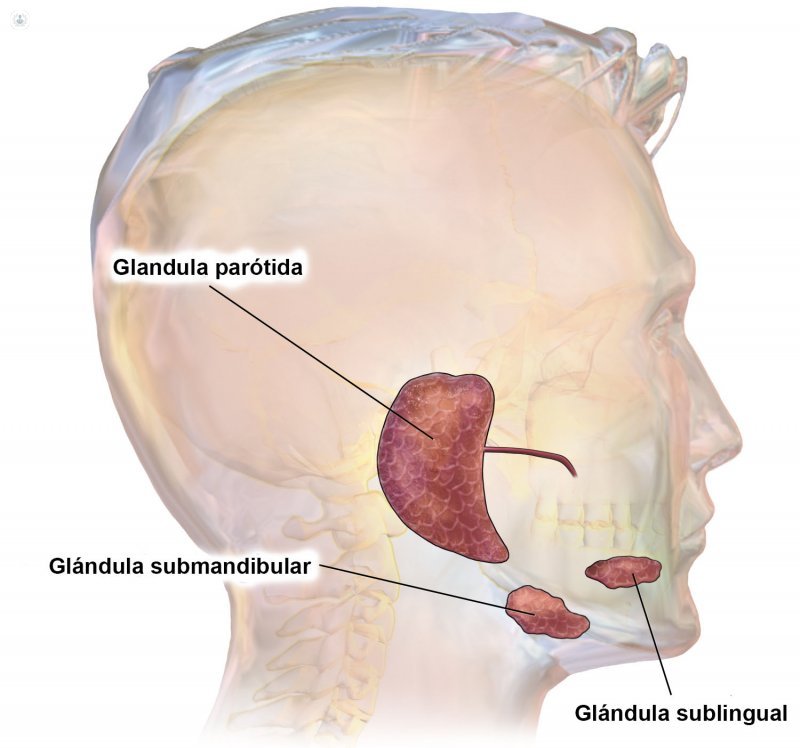 tumores glandulas salivales