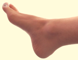 El doctor Cabestany, experto en lesiones de tobillo, explica en este artículo que es una tendinitis de tobillo, porqué se produce y el tratamiento a realizar.