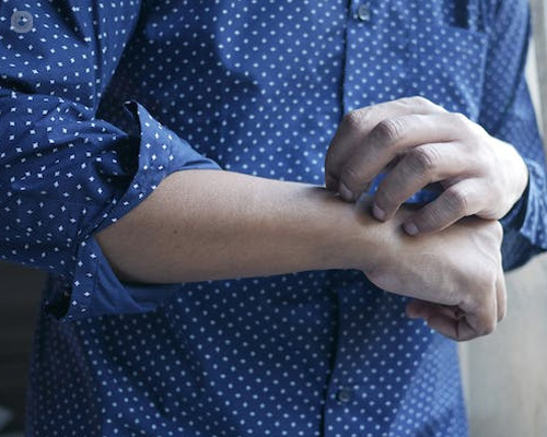 Primer plano de los brazos de un chico rascándose los brazos - Alergias en la piel - by Top Doctors