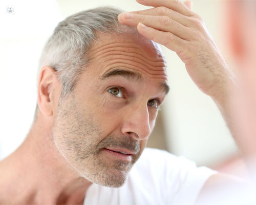 Hombre mirándose en un espejo y tocándose el pelo - alopecia masculina - by Top Doctors
