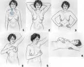 Autoexploracion de senos como metodo de deteccion precoz