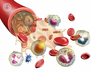 Enfermedades de la sangre: qué es, síntomas y tratamiento | Top Doctors