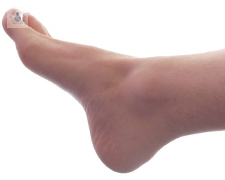 Fractura de pie: qué es, síntomas y tratamiento | Top Doctors