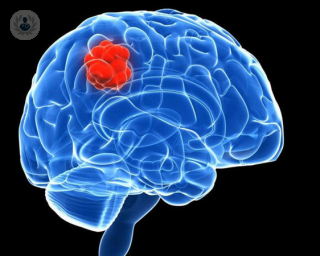 cerebro, tumor, posible tumor, tumor cerebral