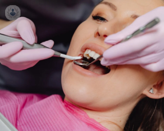 implantes dentales factores exito mantenimiento