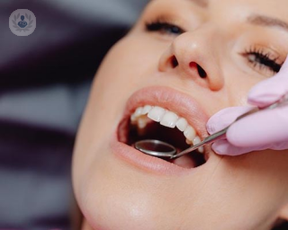 boca mujer en el dentista