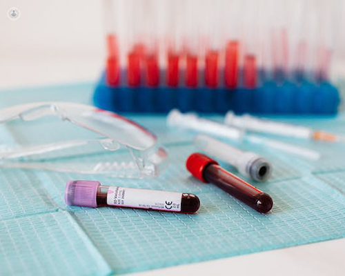 Primer plano de unas muestras de sangre - Clopidogrel (genotipado de CYP2C19) | Top Doctors