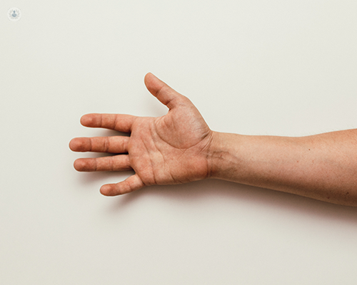 Artrosis dedos mano: qué es, síntomas y tratamiento | Top Doctors