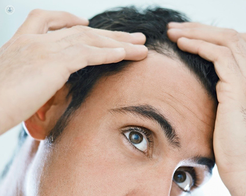 Causas y remedios para la alopecia | Top Doctors