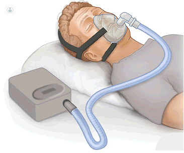 Ronquido y apnea del sueño – Laboratorioceosa