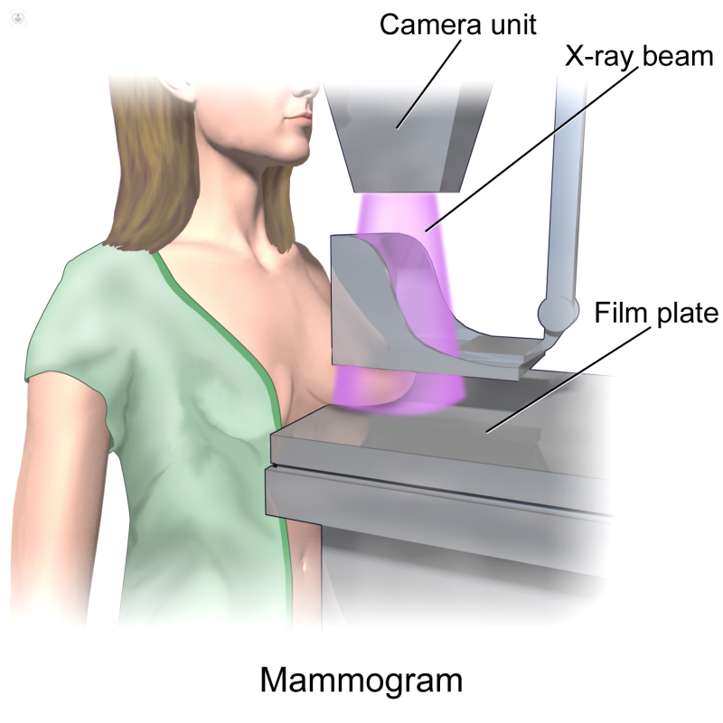 Mamografía: a partir de cuánto y cada cuánto
