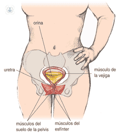Tratamiento incontinencia urinaria con malla | urólogo - Alicante