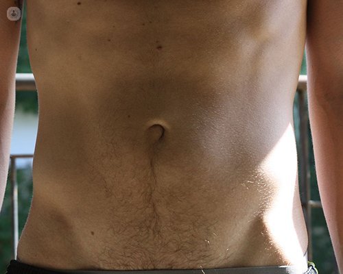 Abdominoplastia | Cirujano plástico - Las Palmas de Gran Canaria