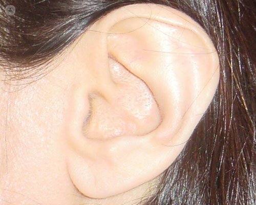 Operación de oído medio para otitis y pérdida auditiva