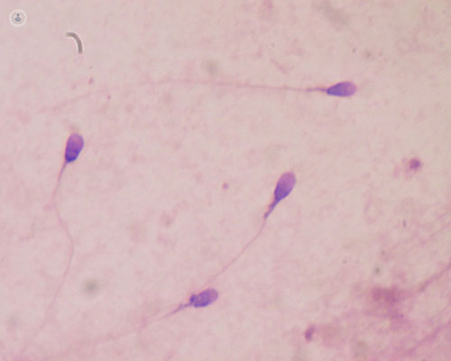 Fragmentación del ADN en los espermatozoides