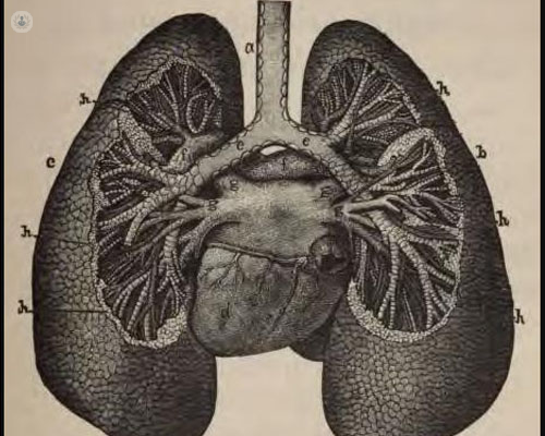 Enfisema pulmonar: qué es, síntomas y tratamiento | Top Doctors