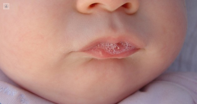 Cirugía de las glándulas salivales: qué es, síntomas y tratamiento | Top  Doctors