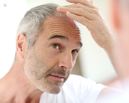 músculo afeitado Retencion Pérdida de cabello: cuándo acudir al especialista | Top Doctors