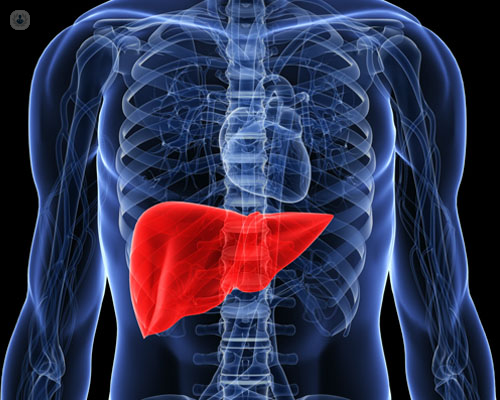 Hígado graso: qué es, síntomas y tratamiento | Top Doctors