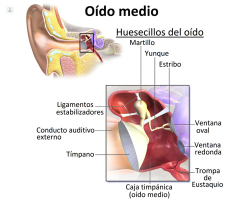 Cirugía del oído medio: qué es, síntomas y tratamiento | Top Doctors