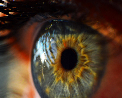 Ojos llorosos (lagrimeo): qué es, síntomas y tratamiento | Top Doctors